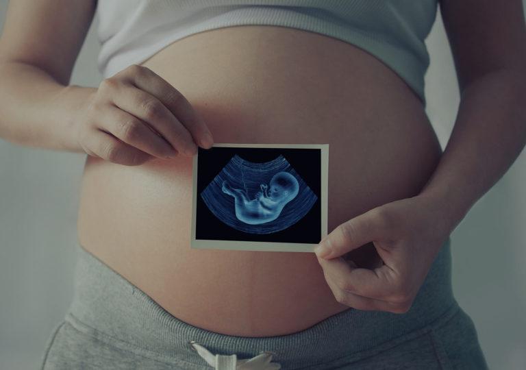 femme enceinte qui montre une photo de son échographie