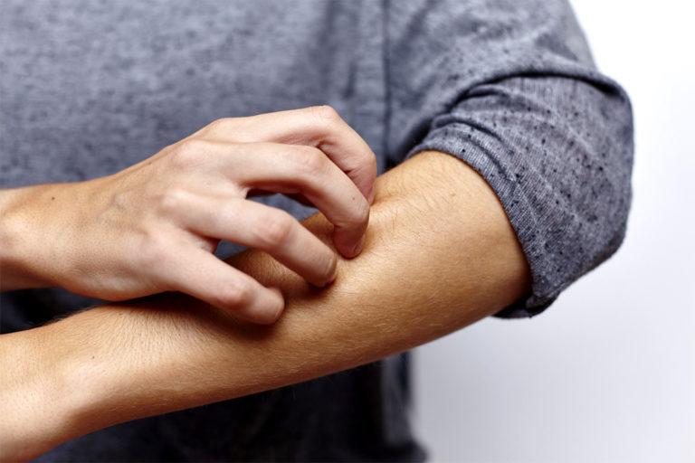 psoriasis musicotherapie